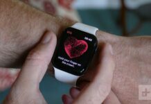 Apple Watch What does the future hold